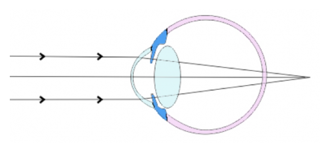 Question 9